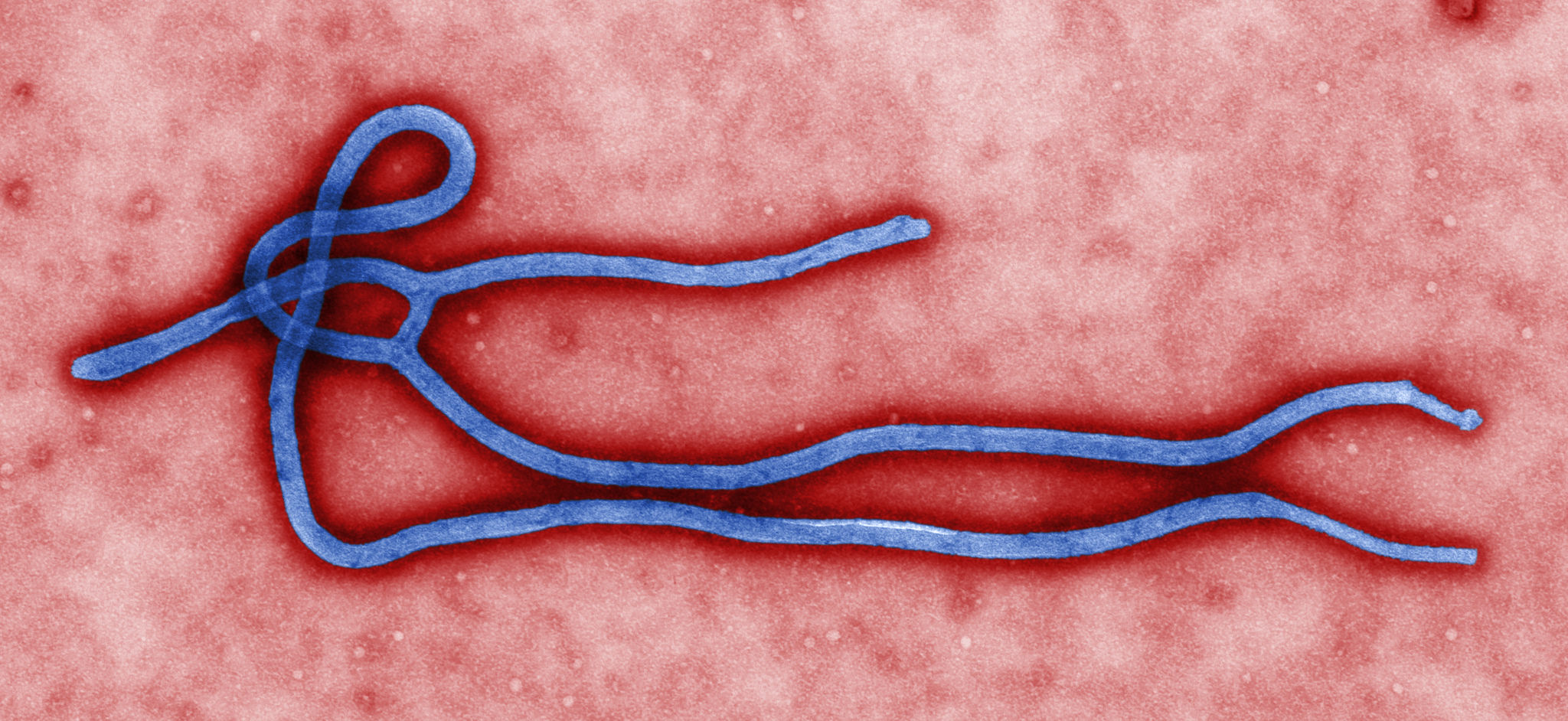 Ebola epidemic: changing how we do development?